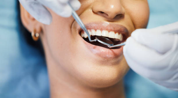 Best Emergency Dental Care for Broken or Chipped Teeth in Eunice, NM